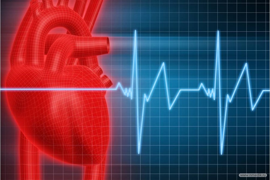 Аритмия сердца - что это, каковы причины, симптомы и методы лечения