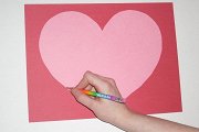 Вросший ноготь. Причины, профилактика и методы лечения рекомендации Вросший ноготь. Причины, профилактика и методы лечения рекомендации