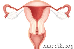 Миома матки (фибромиома) - виды, симптомы и методы лечения