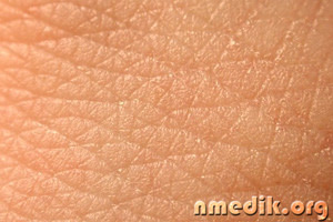 Основные патогистологические изменения кожи