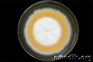 Грибковые заболевания кожи - на фото выращенный грибок рода Trichophyton