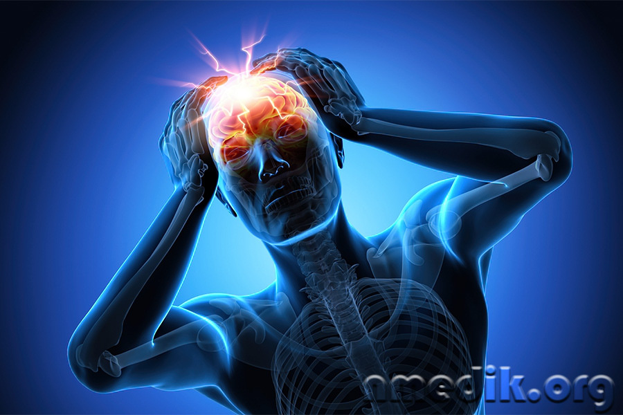 Энцефалит – воспалительный процесс в головном мозге