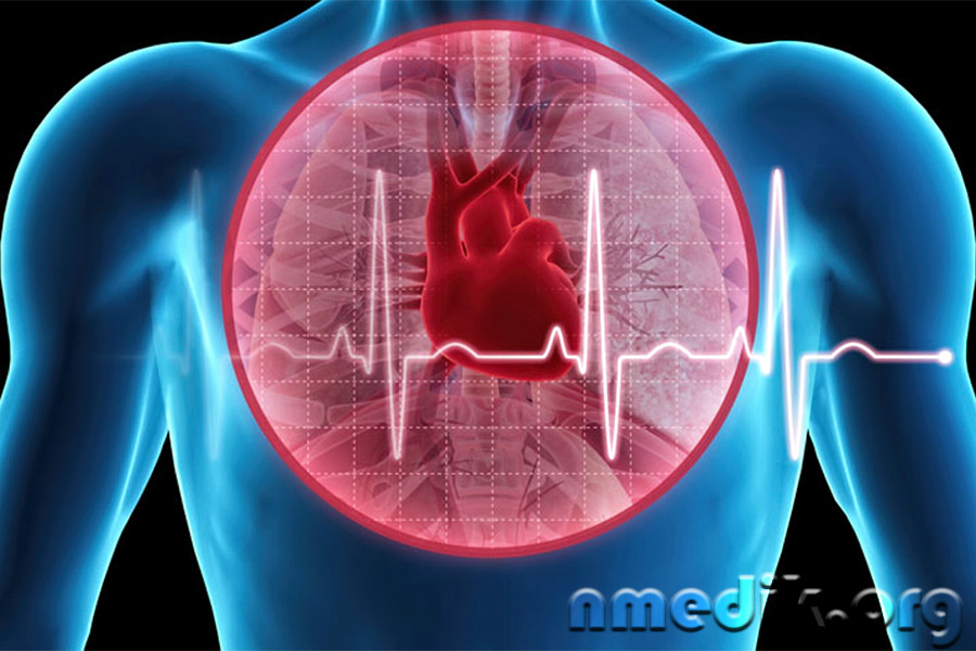 Порок сердца – аортальный стеноз