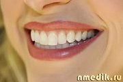 Амальгамы, применяемые в зубоврачебной практике могут вызвать аллергию