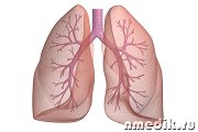 Пневмония (воспаление легких) - симптомы, лечение